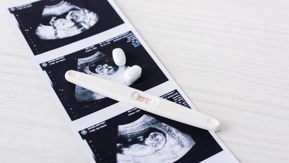 pills-and-pregnancy-test-on-ultrasound-image-2022-12-16-18-00-47-utc
