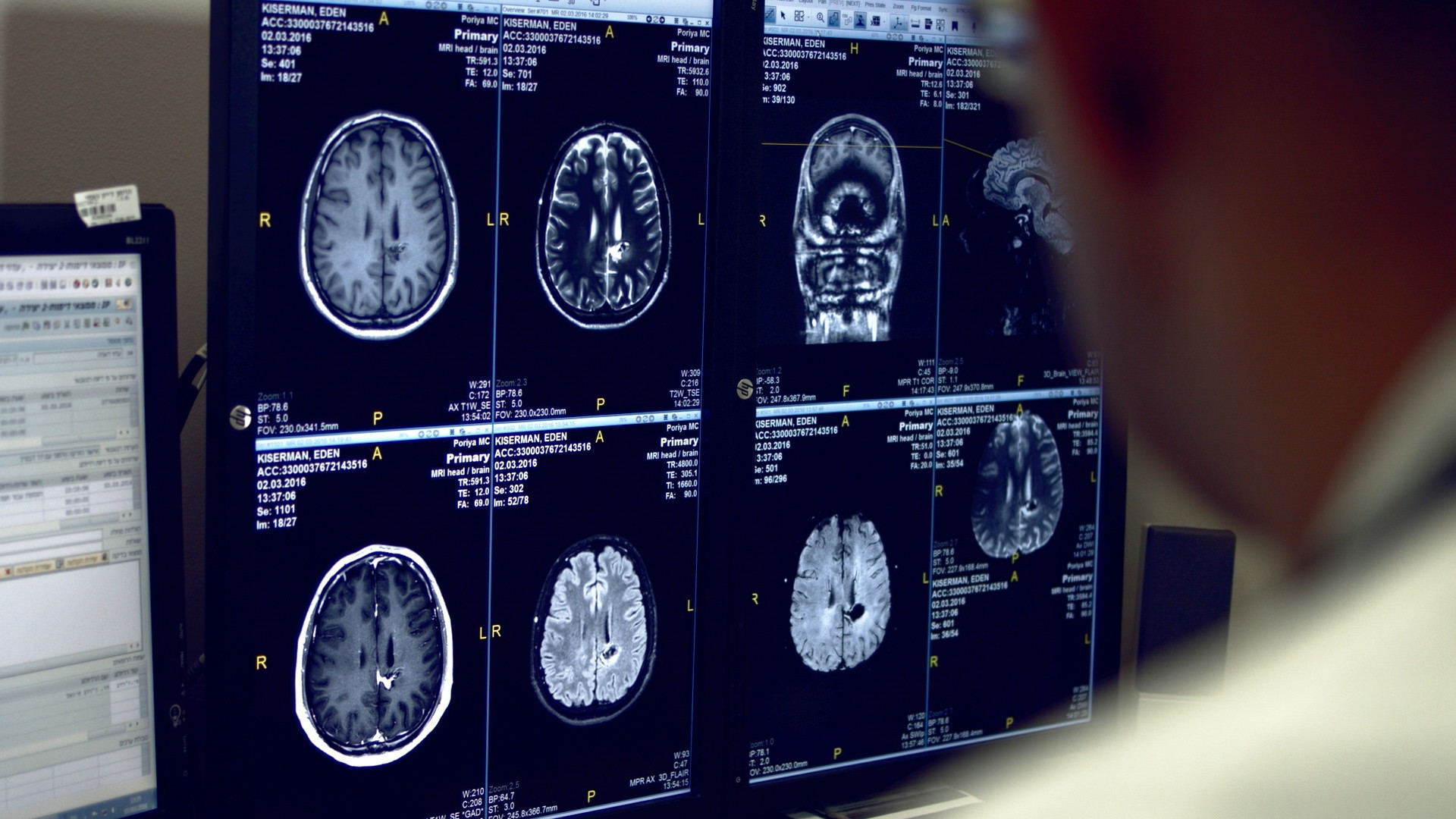 38177_doctor_looking_at_brain_scan_on_screen_By_PPH_Artlist_HD